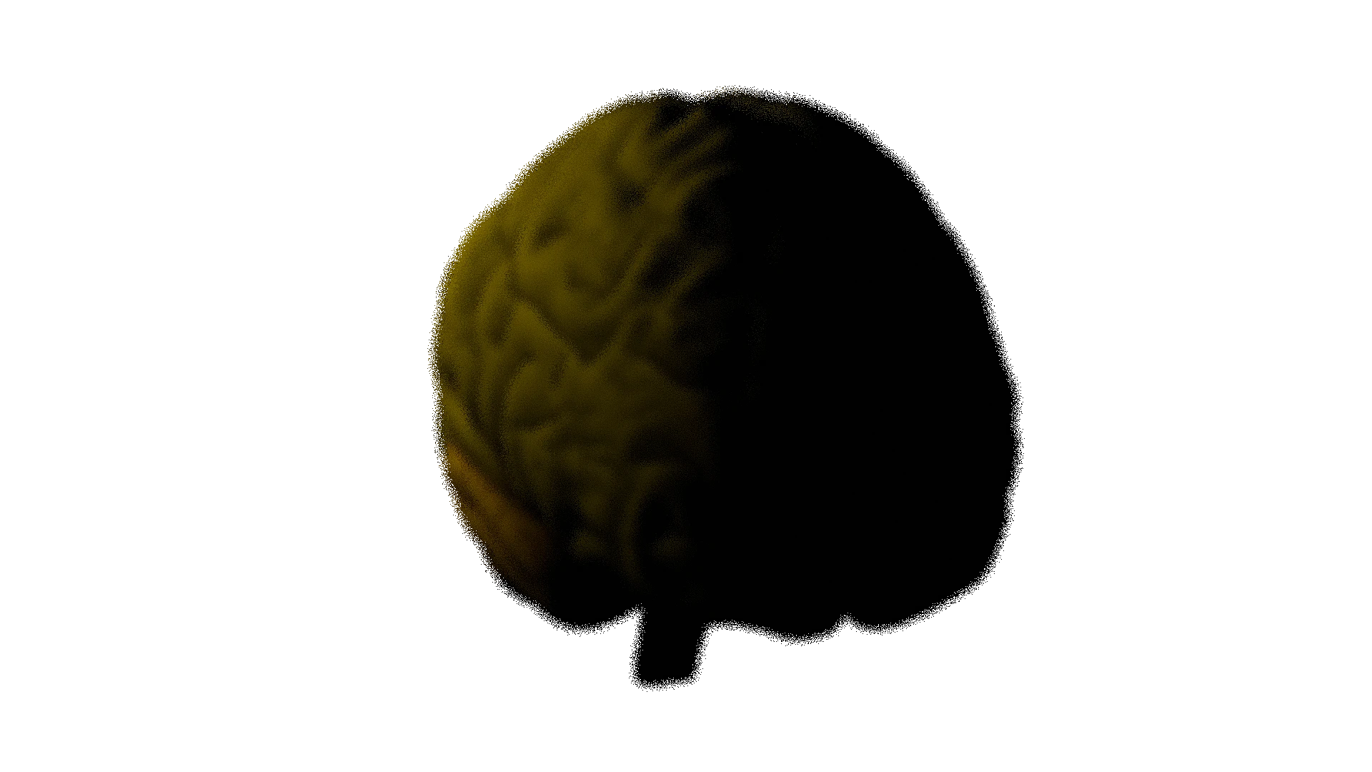 brain